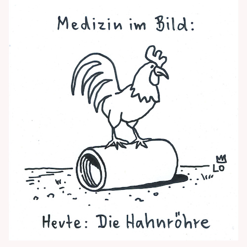 Cartoon: Medizin im Bild (medium) by Lo Graf von Blickensdorf tagged medizin,urologie,röhre,katharr,cartoon,hahn,urin,wortspiel,medizin,urologie,röhre,katharr,cartoon,hahn,urin,wortspiel