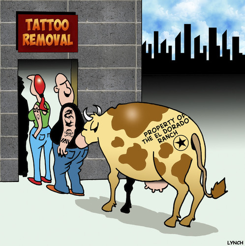 Tattoo removal